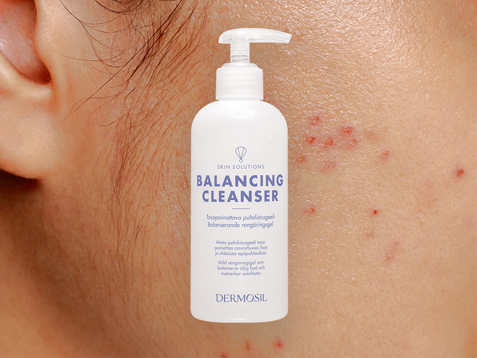 Rasvoittuvan ihon puhdistus